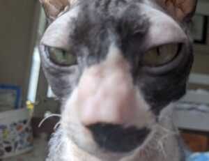 how can gasteromaradical disease be treated